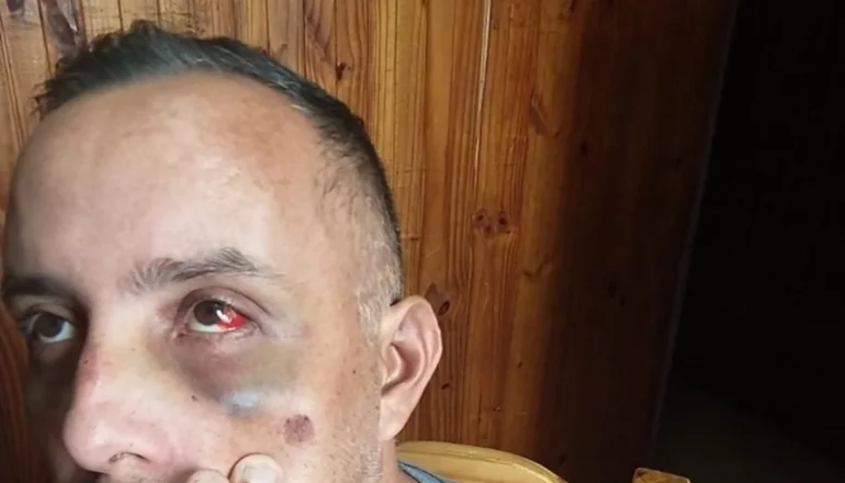 "Nunca me bajé del auto a pelear, me pegaron y quedé inconsciente"
